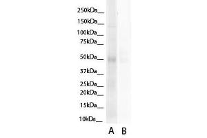 WB Suggested Anti-HNF4A Antibody Titration:  0.