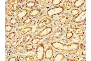 Immunohistochemistry of paraffin-embedded human renal tissue using ABIN7165680 at dilution of 1:100 (PKC alpha antibody  (AA 495-659))