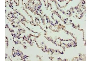 Immunohistochemistry of paraffin-embedded human lung tissue using ABIN7165213 at dilution of 1:100 (CNIH3 antibody  (AA 94-138))