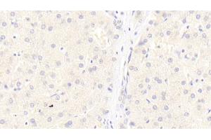 Detection of LRP6 in Human Liver Tissue using Monoclonal Antibody to Low Density Lipoprotein Receptor Related Protein 6 (LRP6) (LRP6 antibody  (AA 981-1213))