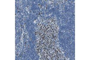 Immunohistochemical staining (Formalin-fixed paraffin-embedded sections) of human lymph node with MCM3 polyclonal antibody  shows strong nuclear positivity in reaction center cells.