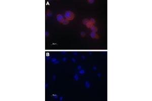 Expression of TRPV5 in PC3 cells - Immunocytochemical staining of paraformaldehyde-fixed PC-3 cells with Anti-TRPV5 Antibody (ABIN7043855, ABIN7043996 and ABIN7043997), (1:100), followed by goat anti-rabbit-AlexaFluor-555 secondary antibody (A). (TRPV5 antibody  (C-Term, Intracellular))