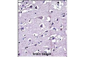 P16 Antibody (C-term) (ABIN657636 and ABIN2846632) iunohistochemistry analysis in formalin fixed and paraffin embedded human brain tissue followed by peroxidase conjugation of the secondary antibody and DAB staining. (MMP16 antibody  (C-Term))