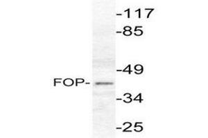 Image no. 1 for anti-FGFR1 Oncogene Partner (FGFR1OP) antibody (ABIN265416) (FGFR1OP antibody)