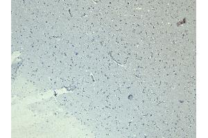 (ABIN6391363) Negative Control showing staining of paraffin embedded Human Cortex, with no primary antibody. (Doublecortin antibody  (Internal Region))