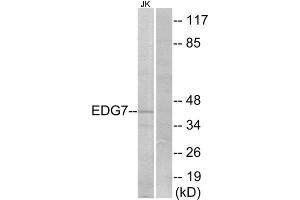Western Blotting (WB) image for anti-Lysophosphatidic Acid Receptor 3 (LPAR3) (Internal Region) antibody (ABIN6301168) (LPAR3 antibody  (Internal Region))