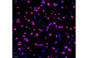 Immunofluorescence (Paraffin-embedded Sections) (IF (p)) image for anti-Transketolase (TKT) antibody (ABIN7075978)