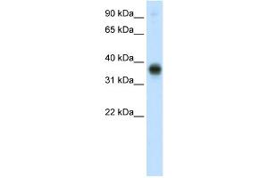 WB Suggested Anti-E2F3 Antibody Titration:  0. (E2F3 antibody  (C-Term))