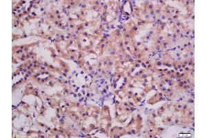 Formalin-fixed and paraffin embedded rat kidney labeled with Rabbit Anti-ATG3 Polyclonal Antibody, Unconjugated (ABIN752533) at 1:200 followed by conjugation to the secondary antibody and DAB staining (ATG3 antibody  (AA 51-150))