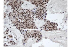 Immunohistochemistry (IHC) image for anti-alpha-1,4-N-Acetylglucosaminyltransferase (A4GNT) (AA 121-340) antibody (ABIN1490880) (A4GNT antibody  (AA 121-340))