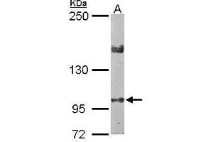 WB Image Sample (50 ug of whole cell lysate) A: Mouse brain 5% SDS PAGE antibody diluted at 1:2000 (LIMCH1 antibody  (C-Term))