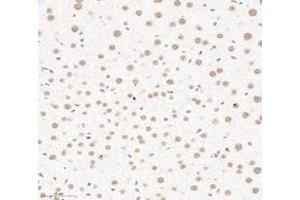 Immunohistochemistry analysis of paraffin-embedded mouse liver using,PQBP1 (ABIN7075126) at dilution of 1: 6000 (PQBP1 antibody)