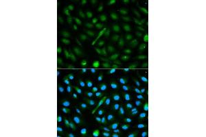 Immunofluorescence analysis of MCF-7 cells using AHSG antibody. (Fetuin A antibody  (AA 19-300))
