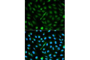 Immunofluorescence analysis of MCF-7 cells using AHSG antibody. (Fetuin A antibody  (AA 19-300))