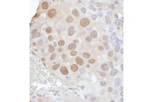 Immunohistochemistry (IHC) image for anti-Phosphate Cytidylyltransferase 1, Choline, alpha (PCYT1A) (AA 317-367) antibody (ABIN7453442) (PCYT1A antibody  (AA 317-367))