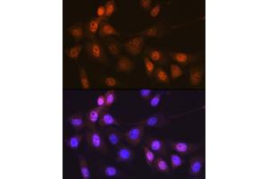 Immunofluorescence analysis of NIH-3T3 cells using Musashi-1 (MSI1) Rabbit mAb (ABIN7268700) at dilution of 1:100 (40x lens). (MSI1 antibody)