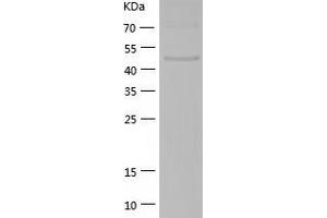 Western Blotting (WB) image for RuvB-Like 2 (E. Coli) (RUVBL2) (AA 2-463) protein (His tag) (ABIN7289439) (RUVBL2 Protein (AA 2-463) (His tag))