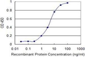 Detection limit for recombinant GST tagged SFRS12 is 0. (SFRS12 antibody  (AA 443-508))