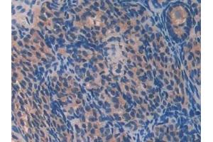Detection of PON2 in Mouse Ovary Tissue using Polyclonal Antibody to Paraoxonase 2 (PON2) (PON2 antibody  (AA 4-289))