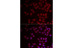 Immunofluorescence analysis of HeLa cell using CIRBP antibody. (CIRBP antibody)