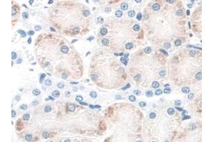 DAB staining on IHC-P; Samples: Mouse Kidney Tissue (CD164 antibody  (AA 24-162))