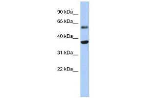 RDH10 antibody used at 1 ug/ml to detect target protein. (RDH10 antibody)