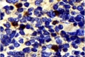 Immunohistochemistry analysis of paraffin-embedded mouse spleen using,NK-p44 (ABIN7074779) at dilution of 1: 500