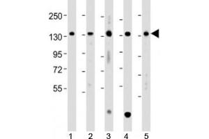 Western blot testing of human 1) A431, 2) HCT116, 3) Jurkat, 4) K562 and 5) U-2OS cell lysate with TACC3 antibody at 1:2000. (TACC3 antibody  (AA 317-350))