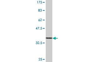 Western Blot detection against Immunogen (36. (SOX10 antibody  (AA 336-433))