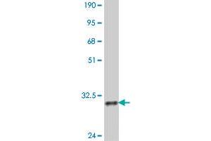 Western Blot detection against Immunogen (32. (PBX4 antibody  (AA 319-374))
