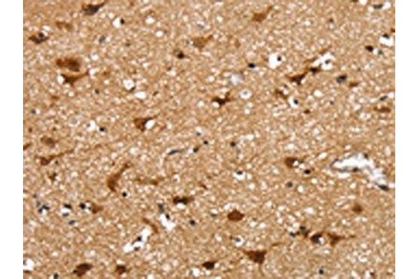 SSBP4 antibody