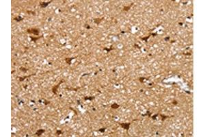 The image on the left is immunohistochemistry of paraffin-embedded Human brain tissue using ABIN7131195(SSBP4 Antibody) at dilution 1/25, on the right is treated with fusion protein.