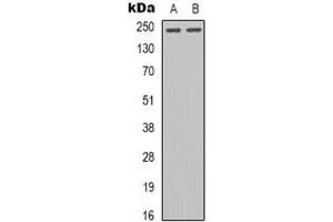 Western blot analysis of Tenascin C expression in U87MG (A), KB (B) whole cell lysates. (TNC antibody  (C-Term))
