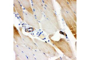 Immunohistochemistry (IHC) image for anti-Insulin Receptor Substrate 1 (IRS1) (AA 1041-1242) antibody (ABIN3043251)