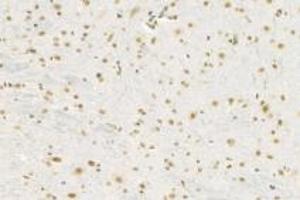 Immunohistochemistry (Paraffin-embedded Sections) (IHC (p)) image for anti-RNA Polymerase II Associated Protein 2 (RPAP2) antibody (ABIN7075481)
