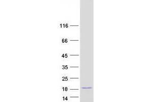 Chromosome 19 Open Reading Frame 25 (C19orf25) protein (Myc-DYKDDDDK Tag)