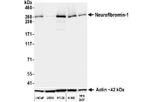 Western Blotting (WB) image for anti-Neurofibromin 1 (NF1) (C-Term) antibody (ABIN7795775) (Recombinant Neurofibromin 1 antibody  (C-Term))