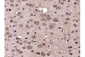 Paraformaldehyde-fixed, paraffin embedded mouse brain, Antigen retrieval by boiling in sodium citrate buffer (pH6) for 15min, Block endogenous peroxidase by 3% hydrogen peroxide for 30 minutes,  Blocking buffer (normal goat serum) at 37°C for 20min, Antibody incubation with Nucleoporin p62 Polyclonal Antibody(bs-2935R) at 1:400 overnight at 4°C, followed by a conjugated secondary and DAB staining. (NUP62 antibody  (AA 451-522))