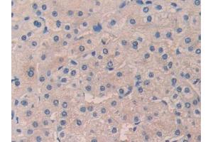 Used in DAB staining on fromalin fixed paraffin-embedded Kidney tissue (desert Hedgehog antibody  (AA 241-383))