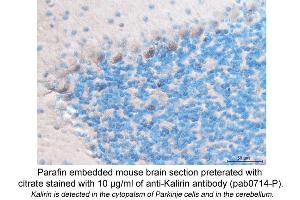 Image no. 1 for anti-Kalirin, RhoGEF Kinase (KALRN) (C-Term) antibody (ABIN559714)