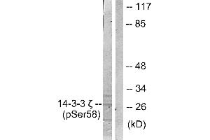 Western blot analysis of extracts from NIH/3T3 cells treated with UV (30mins), using 14-3-3 ζ (phospho-Ser58) antibody. (14-3-3 zeta antibody  (pSer58))