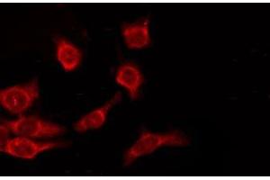 ABIN6276194 staining HuvEc by IF/ICC. (OR9A2 antibody  (C-Term))