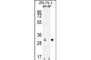 Western blot analysis of RAB40AL Antibdy (N-term) Pab (ABIN655950 and ABIN2845336) pre-incubated without(lane 1) and with(lane 2) blocking peptide in ZR-75-1 cell line lysate. (RAB40AL antibody  (N-Term))