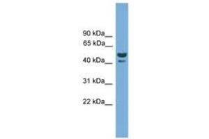 Image no. 1 for anti-Anomalous Homeobox (ANHX) (AA 51-100) antibody (ABIN6744904) (ANHX antibody  (AA 51-100))