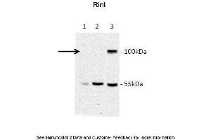 Lanes:  Lane 1: Jurkat lysate Lane 2: HeLa lysate Lane 3: GFP-Rinl transfected COS7 lysate Primary Antibody Dilution:  1:1000 Secondary Antibody:  Goat anti-rabbit-HRP Secondary Antibody Dilution:  1:5000 Gene Name:  RINL Submitted by:  Barbara Woller; Medical University of Vienna (RINL antibody  (N-Term))