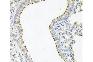 Immunohistochemistry of paraffin-embedded Mouse lung using SCNN1G Polyclonal Antibody at dilution of 1:100 (40x lens). (SCNN1G antibody)