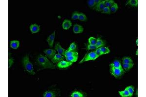 Immunofluorescence (IF) image for anti-Protein Tyrosine Phosphatase-Like (Proline Instead of Catalytic Arginine), Member B (PTPLB) (AA 7-41) antibody (ABIN7175441)