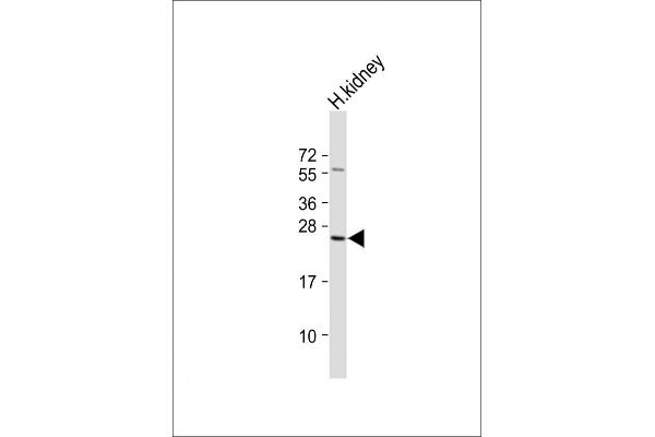 RAB28 antibody  (AA 119-147)