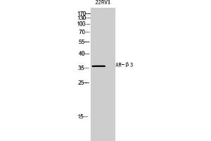 Western Blot analysis of 22RV1 cells using AR-β3 Polyclonal Antibody diluted at 1:1000.