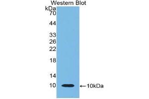 Western blot analysis of the recombinant protein. (beta-Thromboglobulin antibody  (AA 46-107))